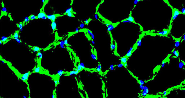 Sarcopenia nell’anziano: una nuova molecola migliora la connessione nervo-muscolo e la resistenza fisica