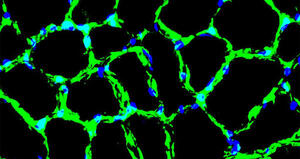 A novel compound enhances nerve-muscle interaction stability and physical endurance, counteracting sarcopenia in the elderly.