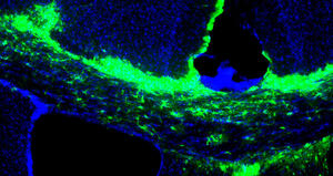 Sclerosi Multipla: un nuovo bersaglio terapeutico per promuovere il riparo della mielina 