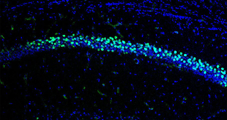 Scoperto un nuovo ruolo del ferro nella regolazione dell’ansia