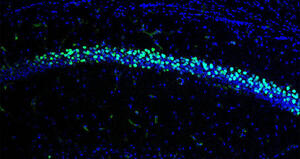 Transferrin Receptor 2 Dependent Alterations of Brain Iron Metabolism Affect Anxiety Circuits in the Mouse.