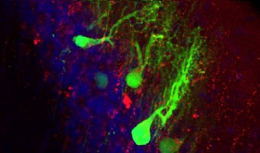 Se i neuroni sopravvivono all'organismo che li genera Se i neuroni sopravvivono all'organismo che li genera