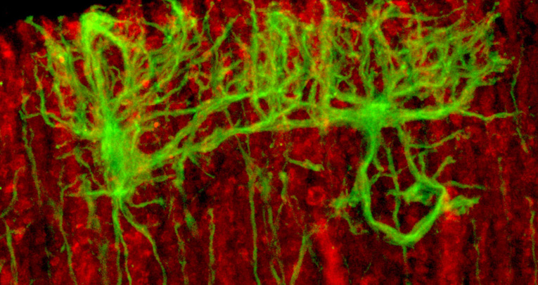Sox2 conditional mutation in mouse causes ataxic symptoms, cerebellar vermis hypoplasia, and postnatal defects of Bergmann glia. Sox2 conditional mutation in mouse causes ataxic symptoms, cerebellar vermis hypoplasia, and postnatal defects of Bergmann glia.