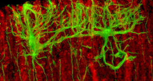 Sox2 conditional mutation in mouse causes ataxic symptoms, cerebellar vermis hypoplasia, and postnatal defects of Bergmann glia.