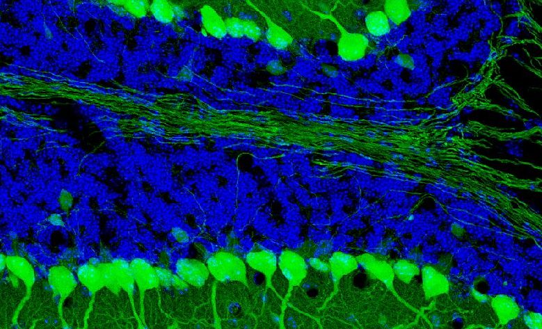 The Cerebellum, K. Leto