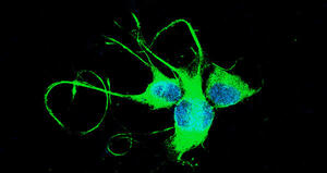 The neurodynamic treatment induces biological changes in sensory and motor neurons in vitro