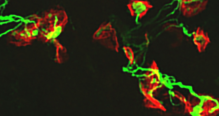 Increasing Agrin Function Antagonizes Muscle Atrophy and Motor Impairment in Spinal Muscular Atrophy. Increasing Agrin Function Antagonizes Muscle Atrophy and Motor Impairment in Spinal Muscular Atrophy.