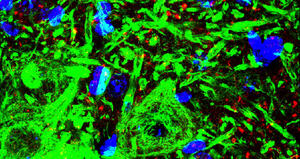 The transcription factor Nurr1 is up-regulated in Amyotrophic Lateral Sclerosis patients and SOD1-G93A mice