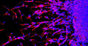 Un nuovo interruttore per mettere in moto la plasticità cerebrale