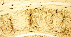 Glia-to-neuron transfer of miRNAs via extracellular vesicles: a new mechanism underlying inflammation-induced synaptic alterations.