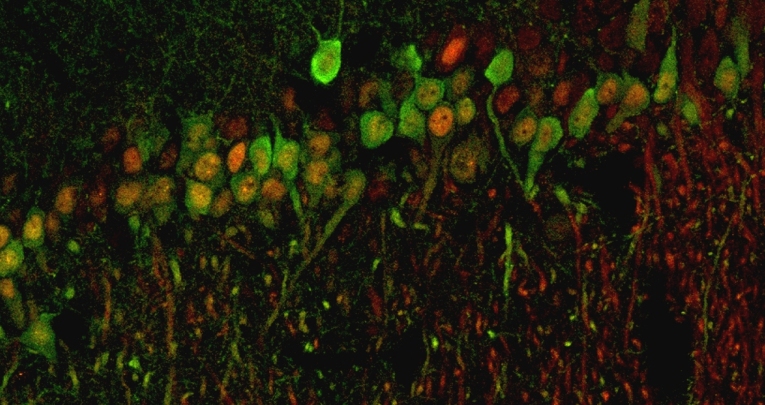 UPDATE IN NEUROSCIENZE DI BASE: MORFOLOGIA E DINTORNI UPDATE IN NEUROSCIENZE DI BASE: MORFOLOGIA E DINTORNI